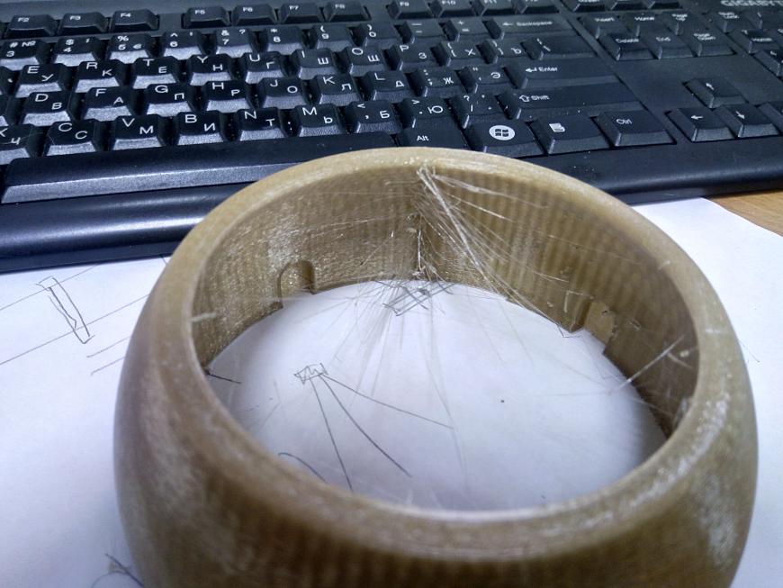 Повышенная волосатость.